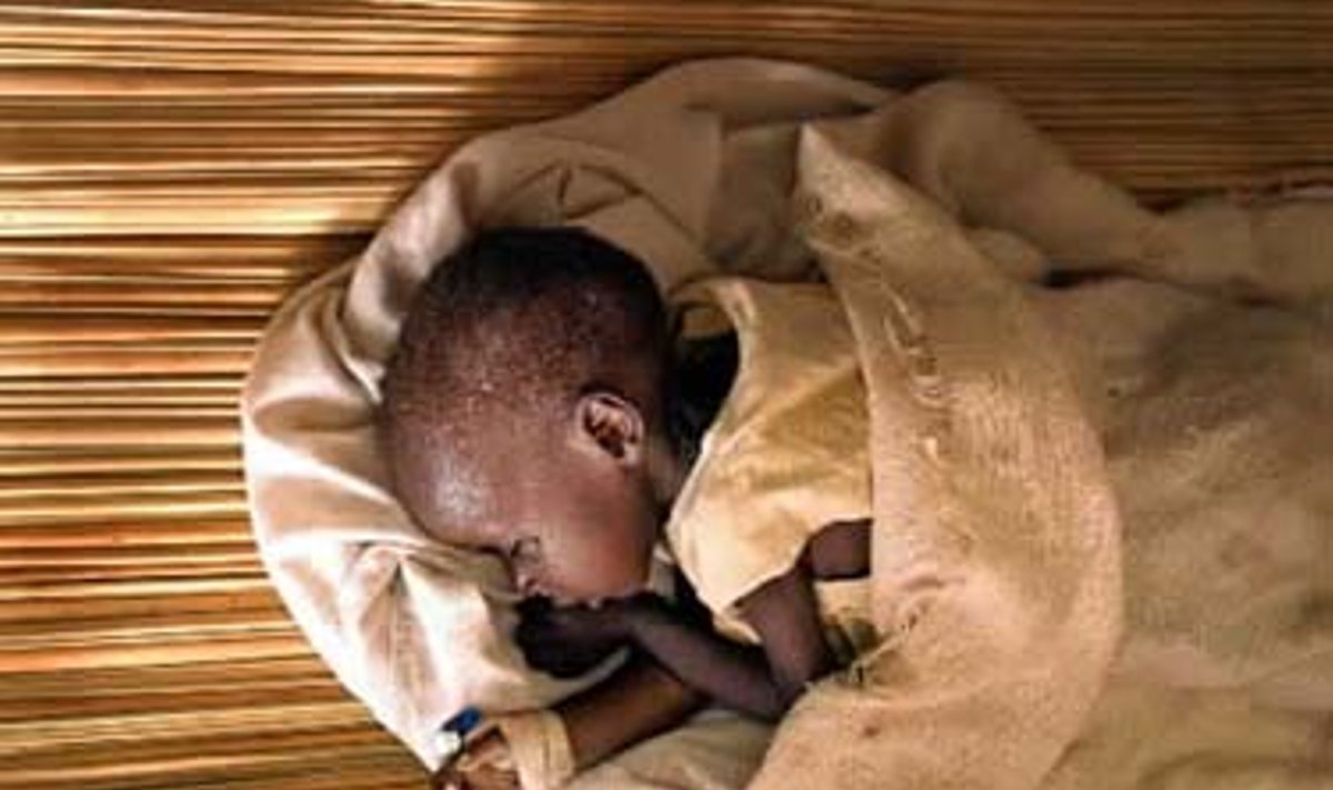 Mažasis ugandietis gydomas ligoninėje dėl maisto trūkumo sukelto išsekimo.