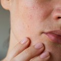 Kosmetologė pasakė tiesą apie dažniausiai girdimus veido priežiūros mitus: odos nereikia „spardyti“