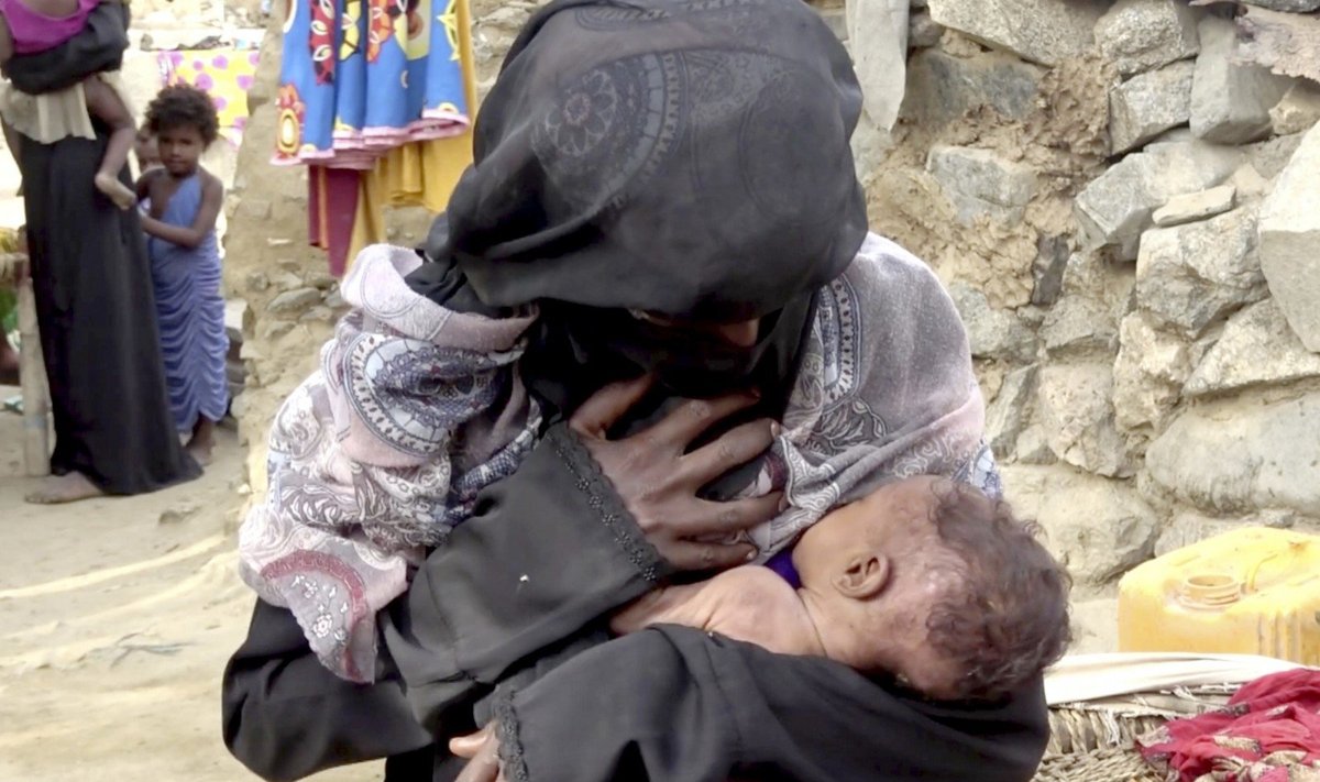 Badas Jemene kelia grėsmę milijonams žmonių