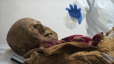 Ekvadoro mumija padės suprasti iš Europos į Naująjį pasaulį patekusių ligų istoriją