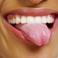 5 patarimai, kurie padės išnaikinti 700 skirtingų burnoje gyvenančių bakterijų rūšių