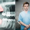 Odontologai protinių dantų siūlo atsikratyti: šie gali tapti sunkių ligų priežastimi