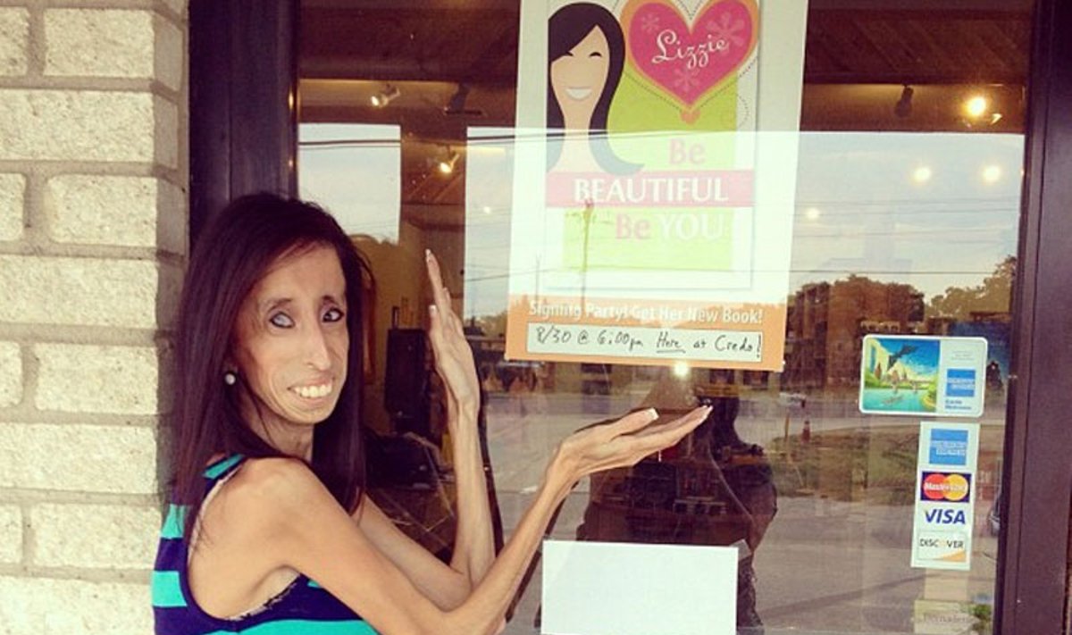 Lizzie Velasquez, Twitter nuotr.