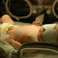Akušerijos praktikantė nepastebėjo geltos: kūdikis tapo neįgaliu