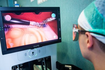 Vaizdas, kurį mato operuojantis chirurgas ekrane