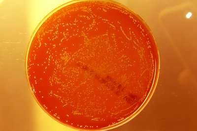 Bakterijos mitybinėje terpėje