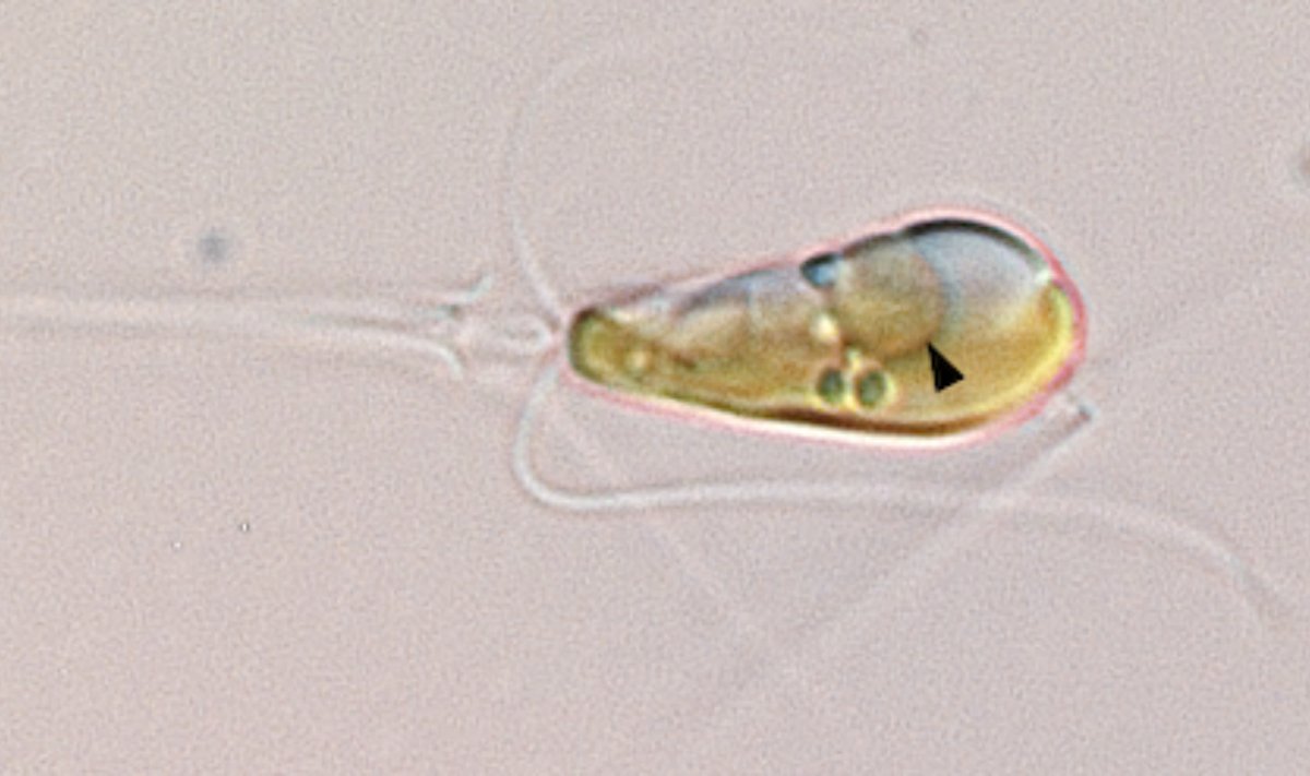 Jūrinė bakterija buvo įtraukta į dumblių šeimininko organizmą ir vystėsi kartu su juo pakankamai ilgai, kad dabar ją galima būtų laikyti organele, dumblių ląstelės mechanizmo dalimi. Tyler Coale/UC Santa Cruz nuotr.
