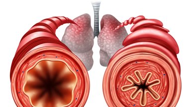 Британские ученые: астма разрушает клетки дыхательных путей, нужны новые лекарств