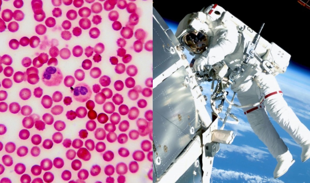 Astronautų kraujyje pastebėti reikšmingi pokyčiai