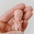 Šiaurės Airija ragina sušvelninti griežtą abortų įstatymą