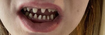 Eglė atsiuntė Turkijoje sužalotų dantų nuotraukas 