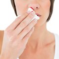 Kraujavimas iš nosies gali būti ir pavojingų ligų požymis: kokios galimos priežastys ir kaip tai sustabdyti?
