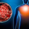 Tyrimas parodė, kaip COVID-19 liga susijusi su mirtinai pavojingais kraujo krešuliais
