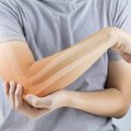 Šį produktą turėtų vartoti kiekvienam vyresnė nei 50 metų: sumažina osteoporozės riziką