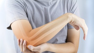 Šį produktą turėtų vartoti kiekvienam vyresnė nei 50 metų: sumažina osteoporozės riziką