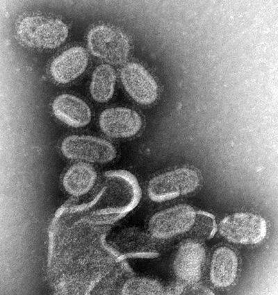 Mokslininkai aptiko hibridinius virusus. Scanpix/J. Hanney et al. nuotr.