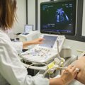 Naujo tyrimo rezultatai sukrečia: ką mokslininkai atrado dar negimusių kūdikių plaučiuose ir smegenyse