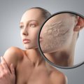 3 patarimai, kaip karantino metu prižiūrėti išsausėjusią odą: jokia priemonė negali tikti, jei odos poros užsidariusios