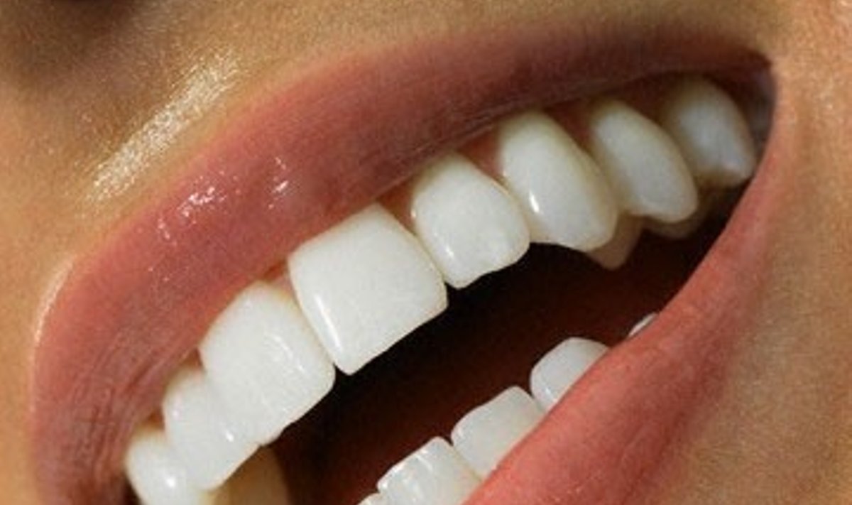 Balti dantys, šypsena