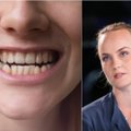 Nekaltas įprotis dieną gali virsti košmariškomis pasekmėmis naktį: kaip atsikratyti dantų griežimo ir stipraus sukandimo