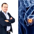 Urologas išvardijo, kam labiausiai gresia prostatos vėžys: vienas veiksnys tikimybę didina net iki 8,8 karto