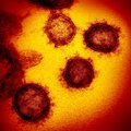 Covid-19: что мы узнали о коронавирусе и пандемии за два года