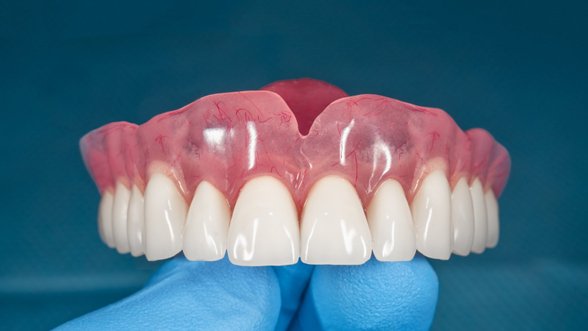 Odontologė patarė dėl dantų protezavimo: tai padės išvengti rimtesnių bėdų