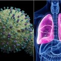 JAV pastebėtas mažai kam žinomo viruso plitimas: sukelia sunkų plaučių uždegimą, bet gydymo dar nėra