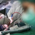 Rumunijoje sulaikytas plastikos chirurgu apsimetinėjęs italas