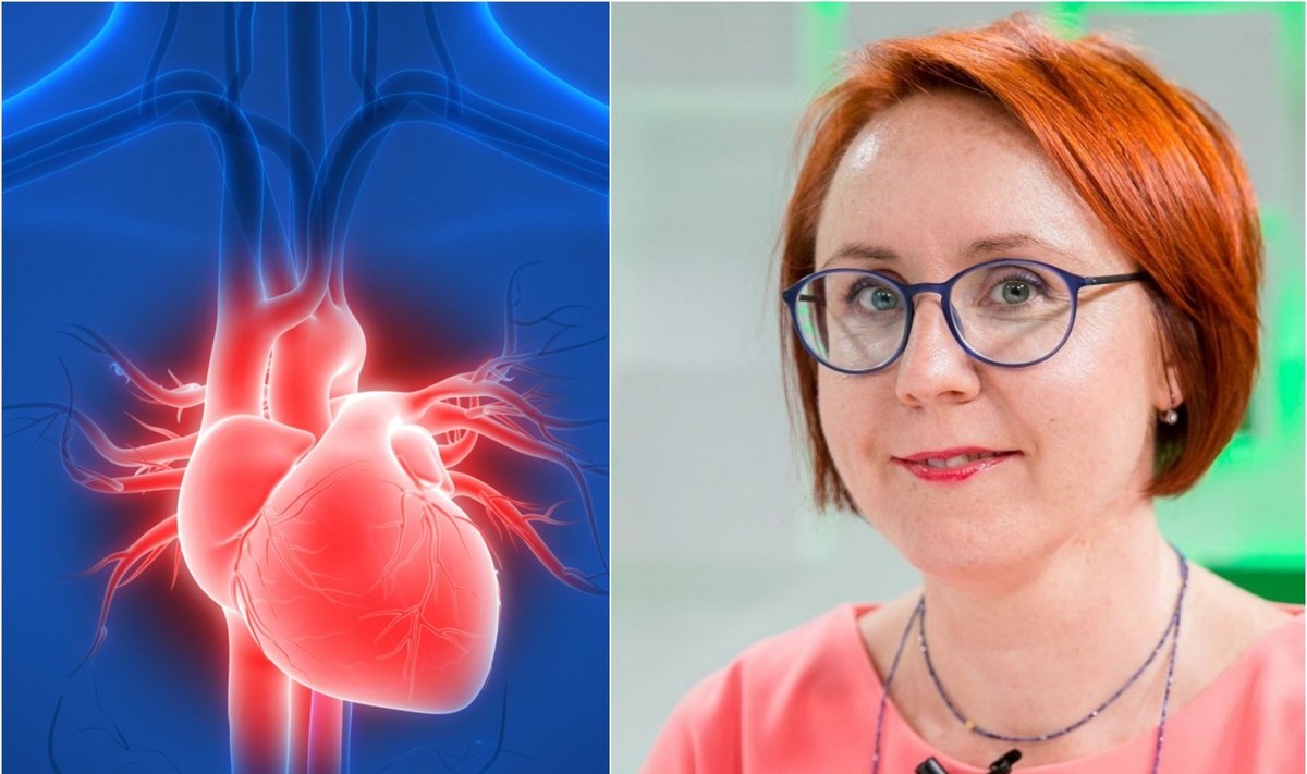 kardiologė Sigita Glaveckaitė