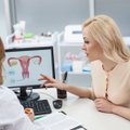 Kontracepcijos priemonė gali lemti mažesnę vėžio riziką