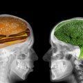 Dažnai persivalgote ir neturite saiko? Mokslininkai išsiaiškino, kas dėl to kaltas – viskas vyksta jūsų smegenyse