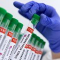 Vakcinos nuo beždžionių raupų tyrimas kelia klausimų dėl apsaugos efektyvumo