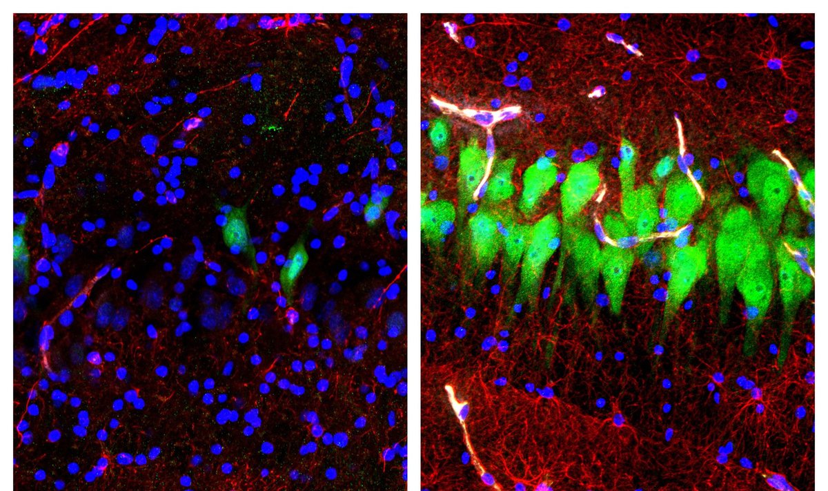 Nuotraukoje kairėje matyti mirusios kiaulės smegenų ląstelės, o dešinėje - atgaivintos ląstelės
