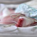 Santaros klinikos paneigė kūdikio netekusios mamos advokato žodžius