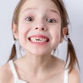 Nekrentantys pieniniai dantys gali byloti apie tam tikras vaiko ligas: medikė papasakojo, ką tėvai turi žinoti apie besikeičiančius dantis