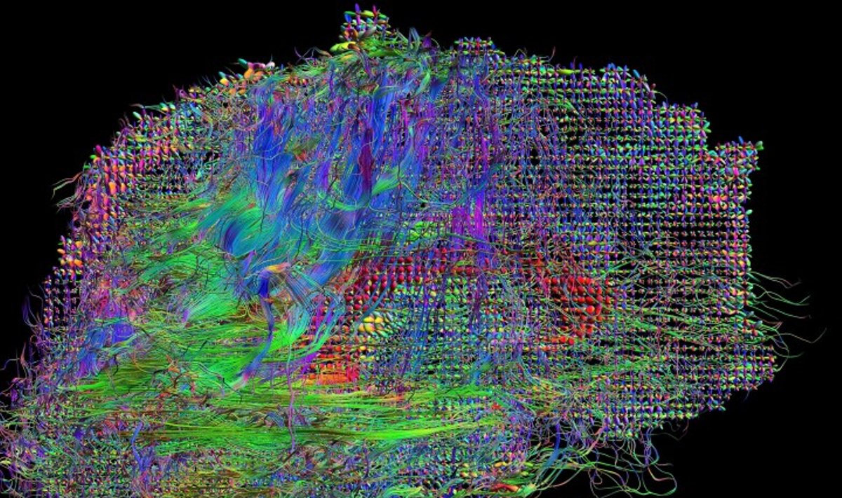 Smegenų neuroninų tinklų žemėlapis. D. Shattuck/P. M. Thompson/humanconnectomeproject.org iliustr.