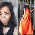 Išskirtinė išvaizda ne kliūtis siekti svajonių: malaizietė nori tapti gražiausia šalies mergina