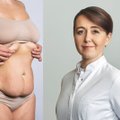Ši bėda ištinka daugelį gimdžiusių moterų – gydytojai pasakė, kaip ją sutvarkyti, kad nekenktų nei išvaizdai, nei sveikatai