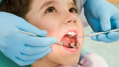 Tėvai žavisi populiaria nemokama procedūra, apsaugančia vaikų dantis nuo galimo gedimo, tačiau odontologė turi įspėjimų