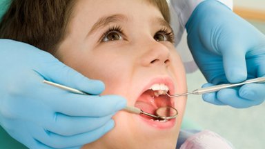 Tėvai žavisi populiaria nemokama procedūra, apsaugančia vaikų dantis nuo galimo gedimo, tačiau odontologė turi įspėjimų