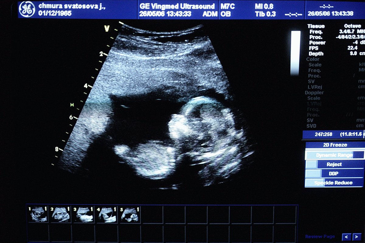 Una donna incinta in visita dal medico è rimasta sbalordita dall’immagine sullo schermo a ultrasuoni
