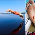 Įsipjauti koją ežere galima visai ne nuo stiklo: kodėl ir kur reikia būti atsargiems
