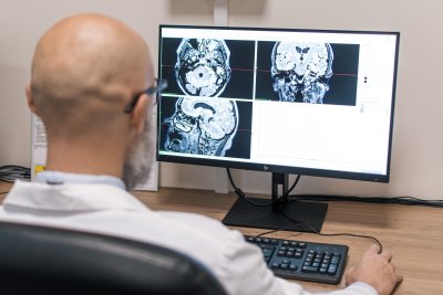 Gydytojas analizuoja galvos smegenų rentgeno nuotraukas.