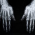 Moters rankų rentgeno nuotrauka suglumino gydytojus