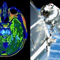 Iš kosmoso grįžusių astronautų smegenis nuskenavę mokslininkai pamatė, kas joms nutinka: pokyčiai – dramatiški