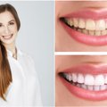 Specialistė įspėja būti atsargiems su balinamosiomis dantų pastomis: kai kurios gali ir pakenkti