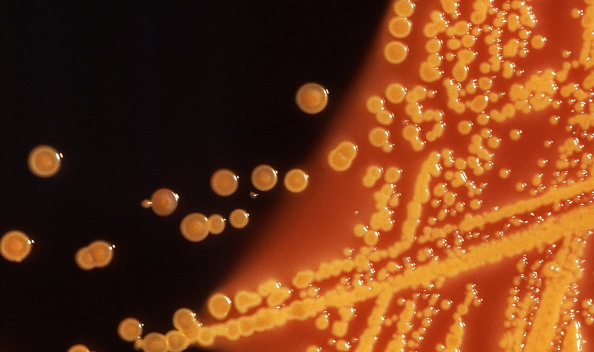 Išsiaiškinta, kaip antibiotikai veikia bakterijas. Scanpix/ZEISS Microscopy nuotr.