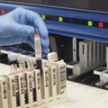Бесплатные тесты на антитела могут сдать не все, круг лабораторий ограничен