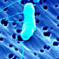 ES institucijos su nerimu prabilo apie bakterijų atsparumą antimikrobinėms medžiagoms